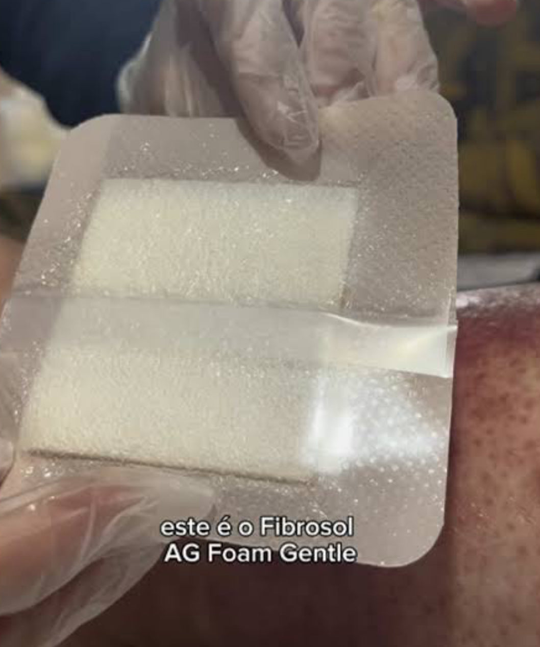 FIBROSOL AG FOAM GENTLE 10 X 10CM